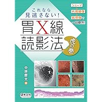 早期胃癌アトラス   /医学書院/細井董三（大型本） 早期胃癌アトラス /医学書院/細井董三（大型本） 早期胃癌